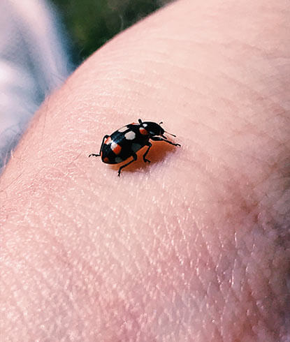 Infected Insect Bite